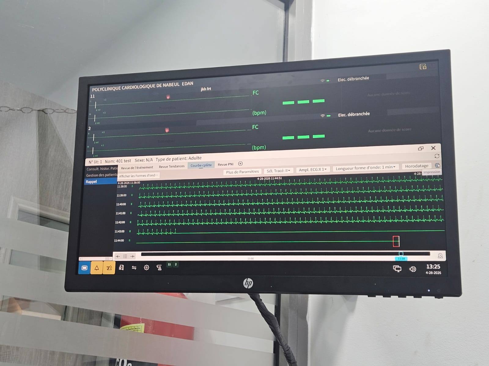  Mise en place de la Télémétrie Cardiaque au 4ème étage