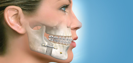 Chirurgie ORL et cervico-faciale - 2