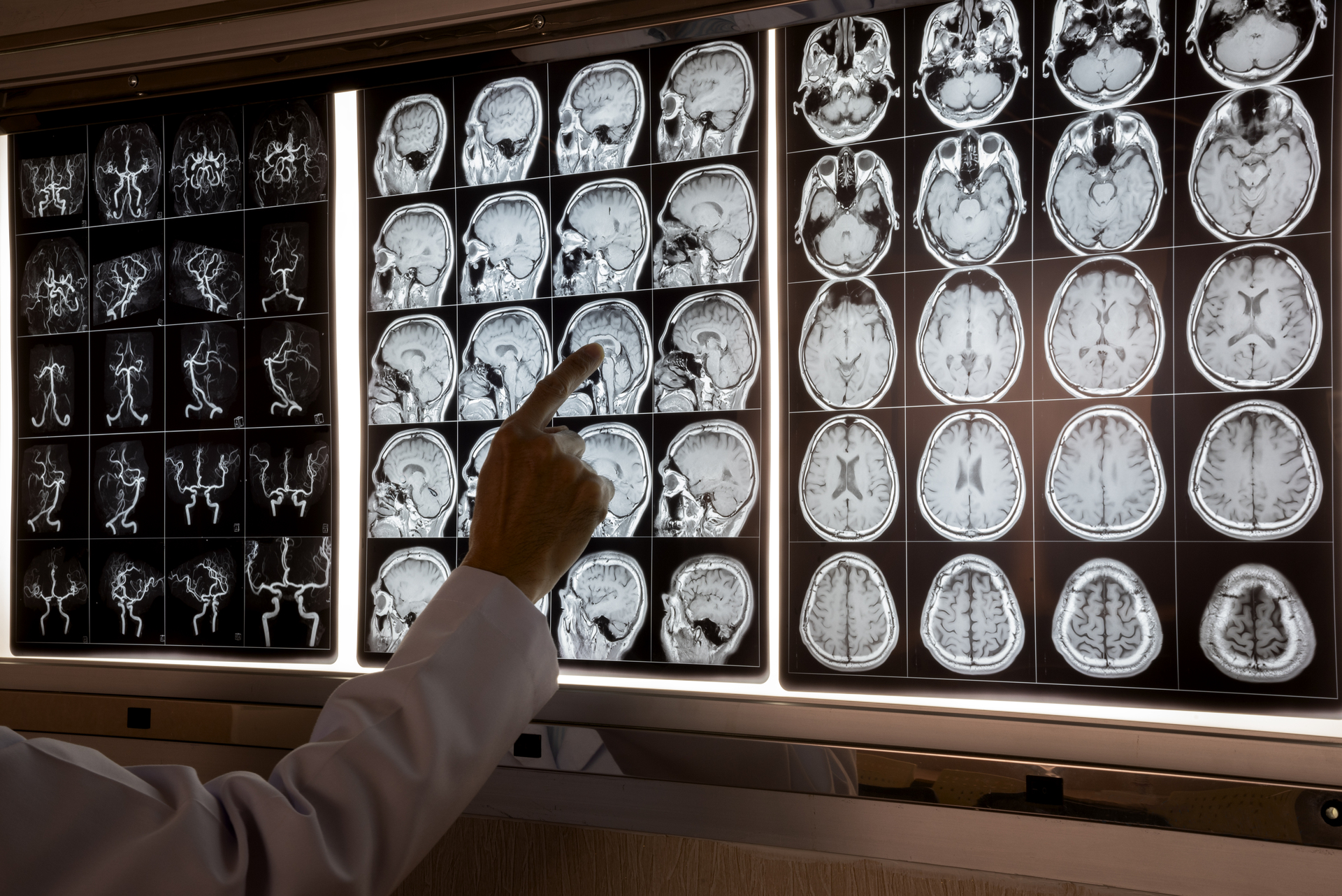 Neurochirurgie - 1