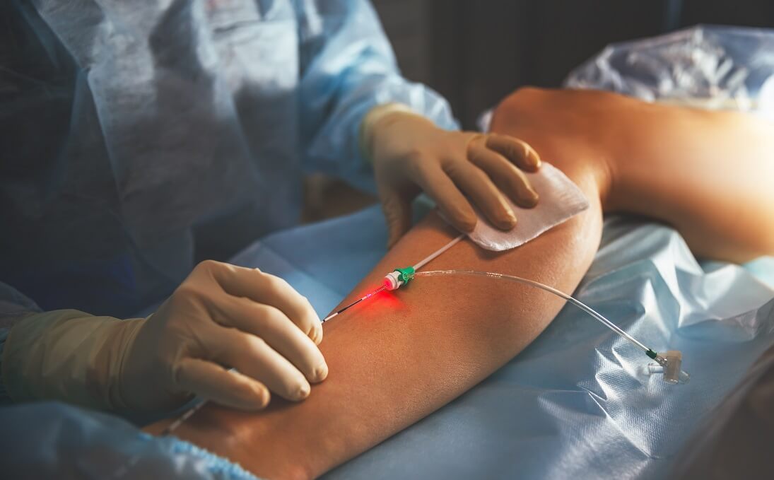 Chirurgie Vasculaire - 1