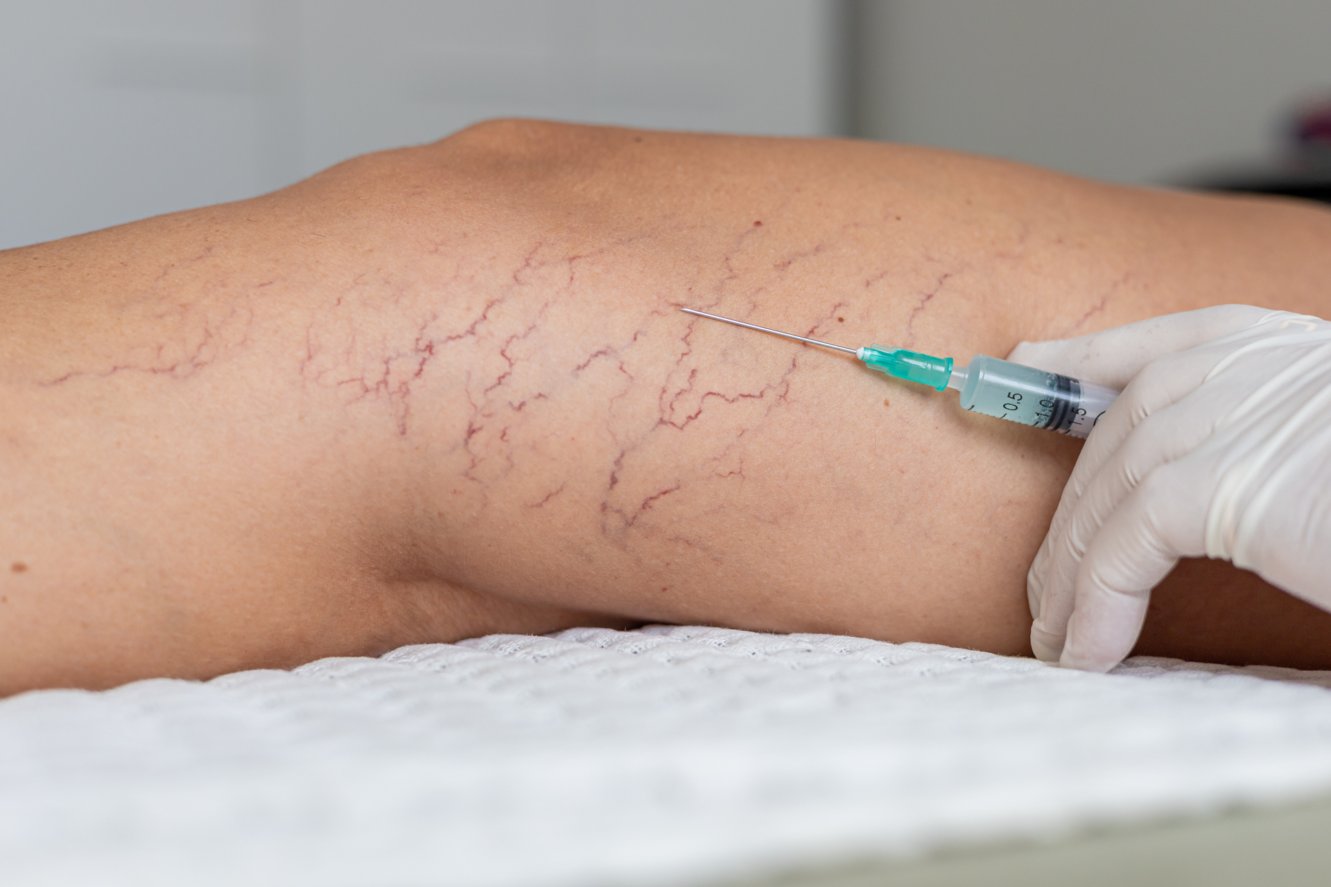 Chirurgie Vasculaire - 2